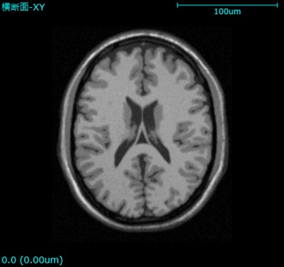 三次元画像の断面図