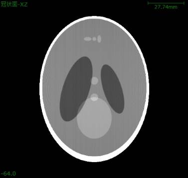 Phase CT3D 