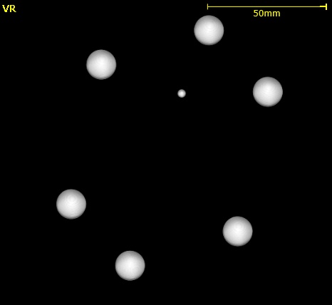 マーカーフォーカシング補正後のCT再構成画像