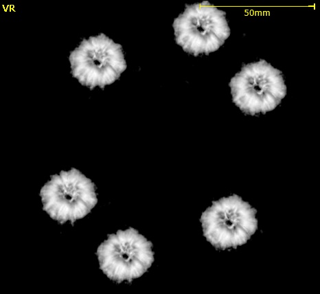 ランダム誤差補正無のCT再構成画像